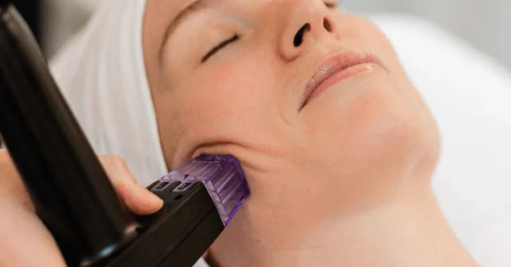 Morpheus 8 in Plano, TX: Transform Your Skin with MD Laser Med Spaβs Advanced RF Microneedling