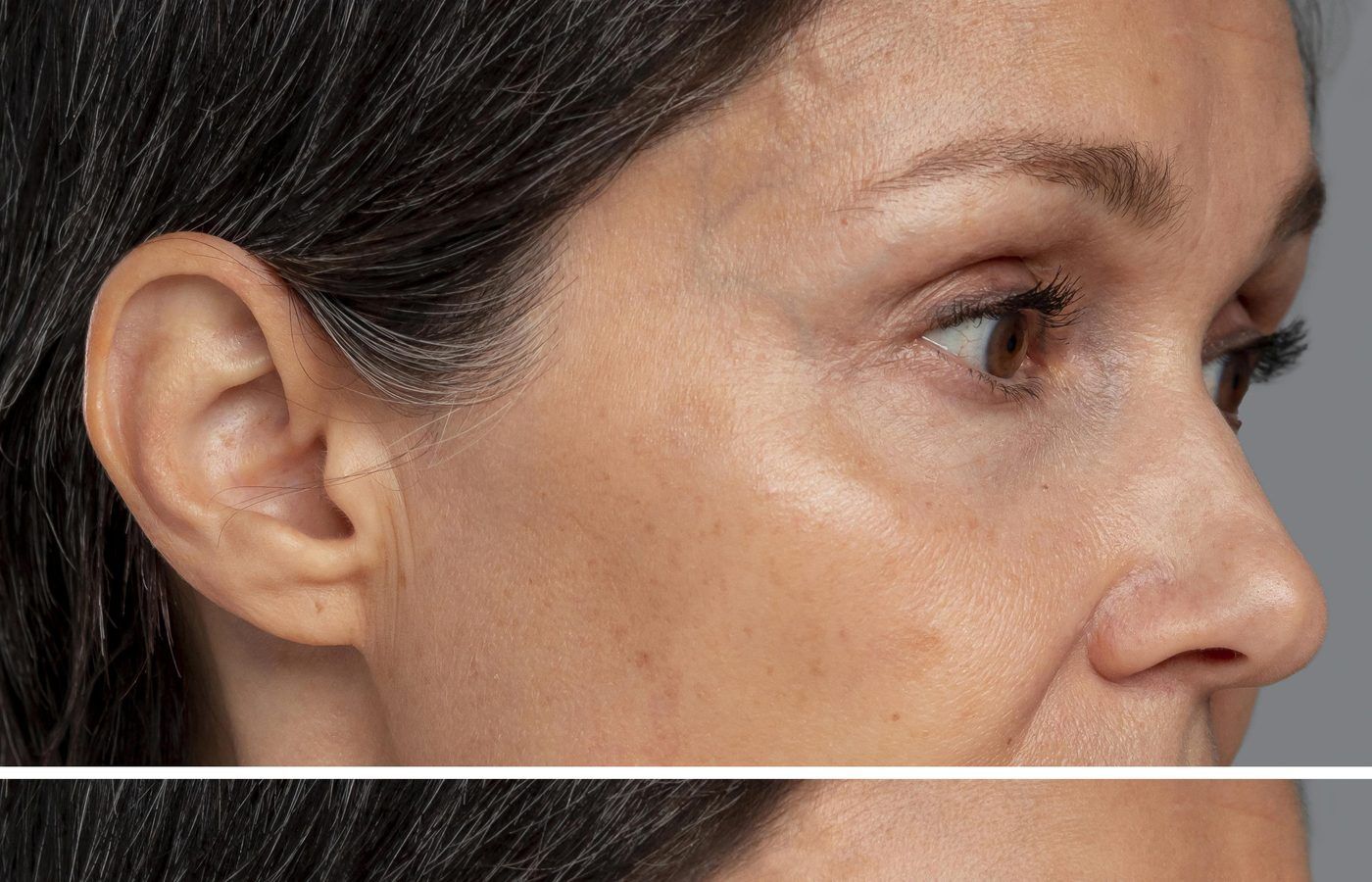 Smooth, bright skin after dermaplaning in Plano, TX