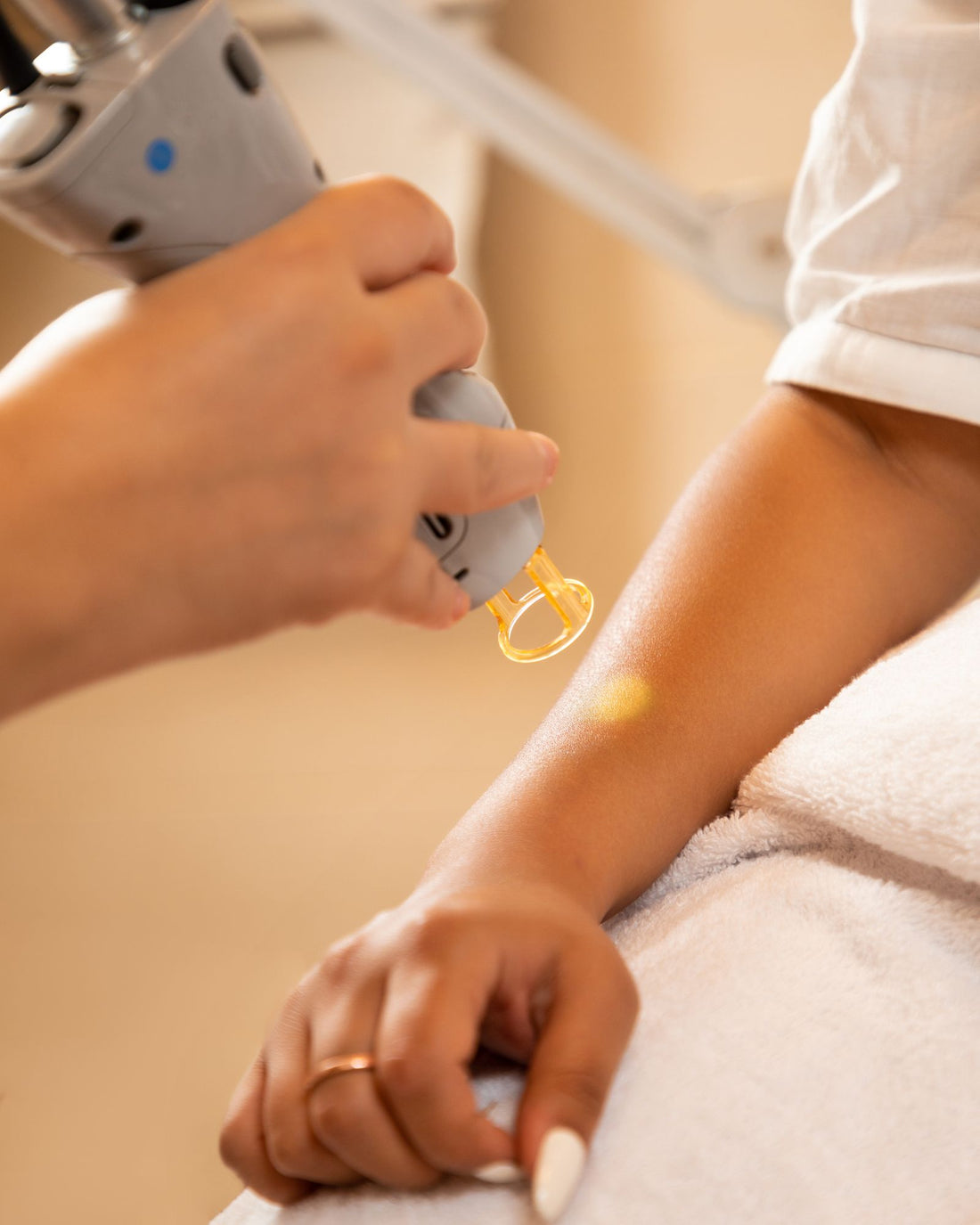 Laser hair removal handpiece being used on a woman's arm