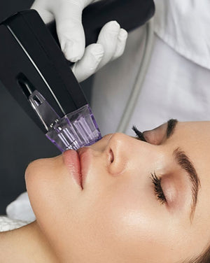 RF Microneedling with Morpheus 8 — Plano, TX | MD Laser Med Spa