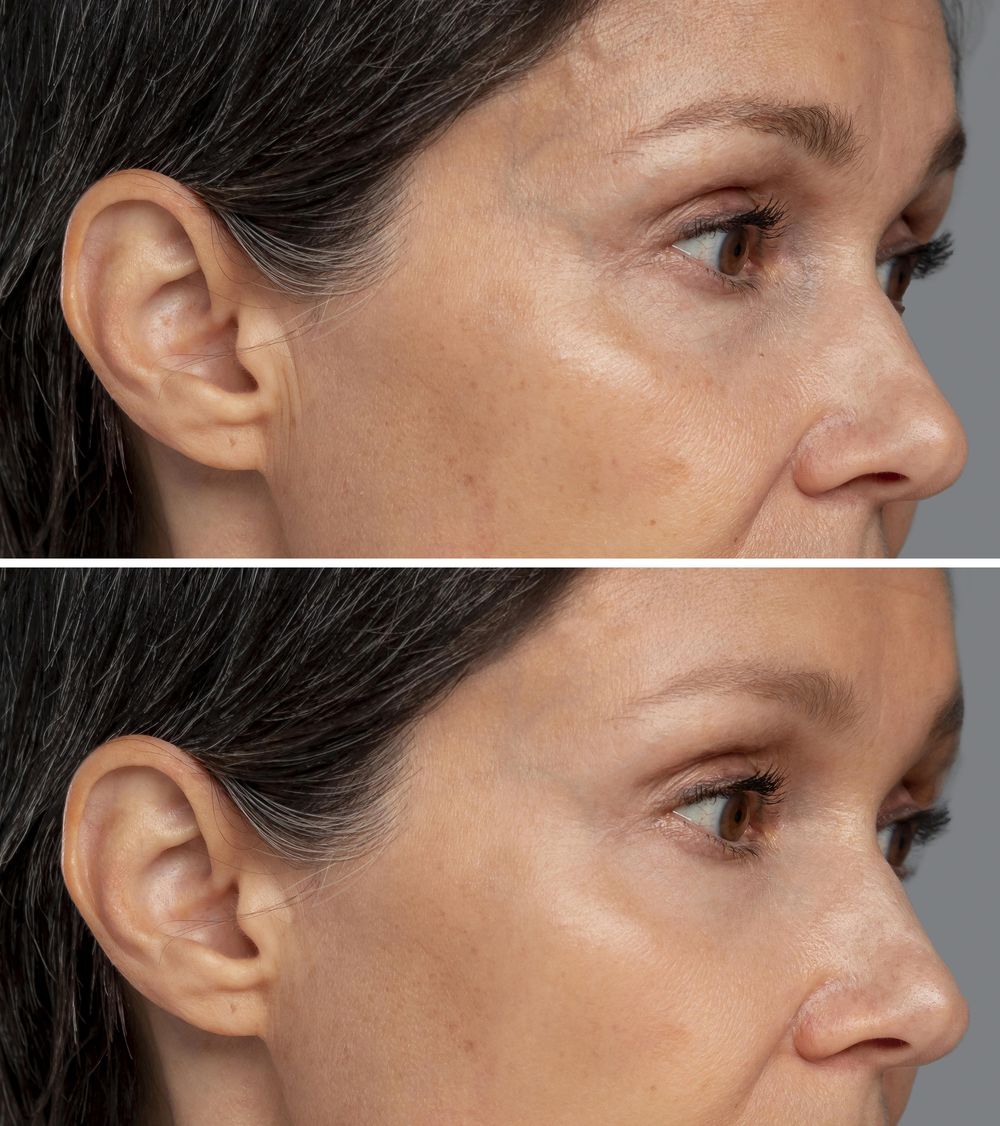 Brighter, more even skin
